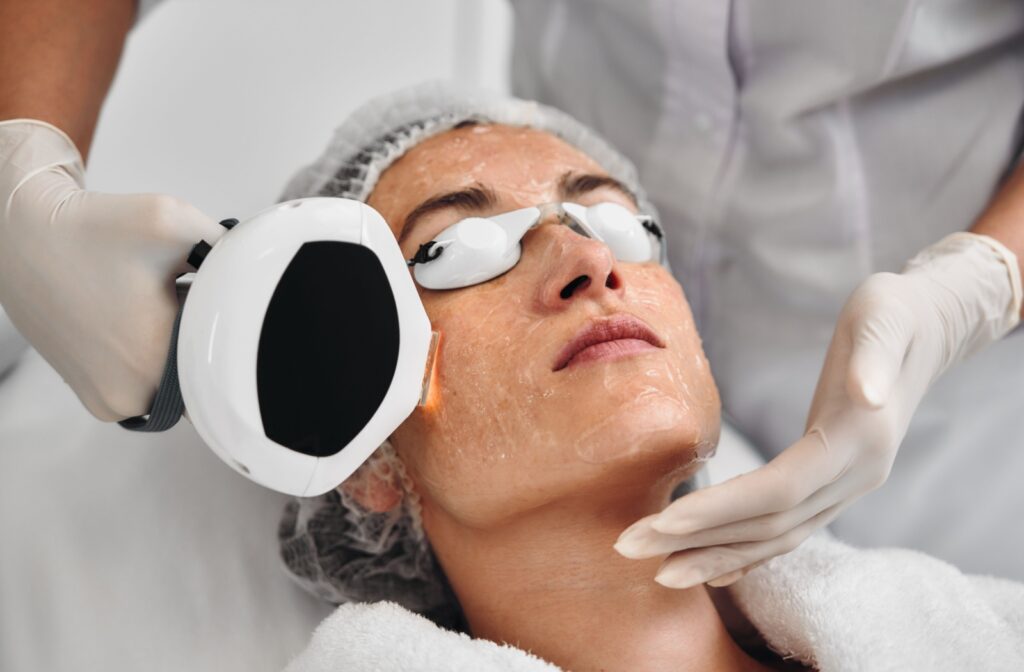 An image of an adult with cooling gel all over their face getting IPL therapy.